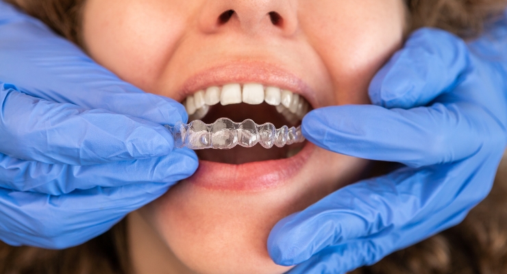 ispravljanje-zagriza