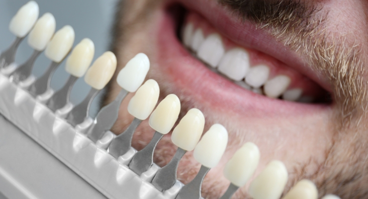 postavljanje-ljuskica-za-zube