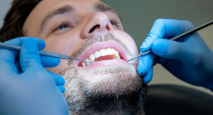 Gdje-obaviti-saniranje-oštećene-zubne-cakline